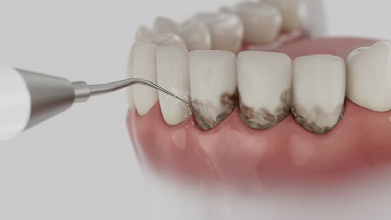 Trusted Teeth Cleaning And Checkup service in Brewer, ME - Dentist Open Now